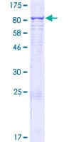 Human CYP4F22 Protein (Recombinant GST)