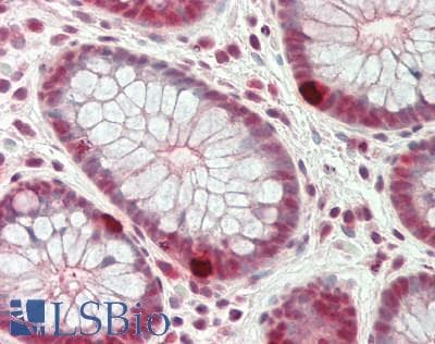 IHC-plus™ CDK6 Antibody