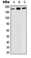 SCOP / PHLPP Antibody (C-Terminus)
