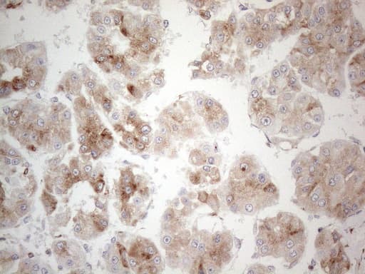 GRN / Granulin Antibody (aa327-593, clone OTI4B9)