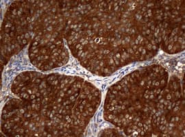 NME1 / NM23 Antibody (clone OTI7F6)
