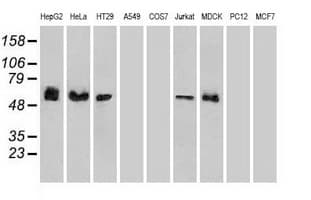 Monoclonal Mouse anti-Human CHEK2 / CHK2 Antibody (clone OTI5C7, IHC, WB)