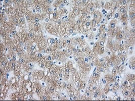RAB17 Antibody (clone OTI5E2)
