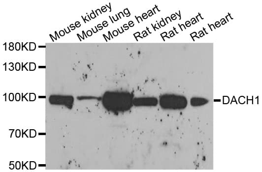 Polyclonal Rabbit anti-Human DACH / DACH1 Antibody (IHC, WB)