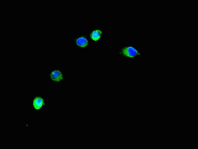 TRIM37 / TEF3 Antibody