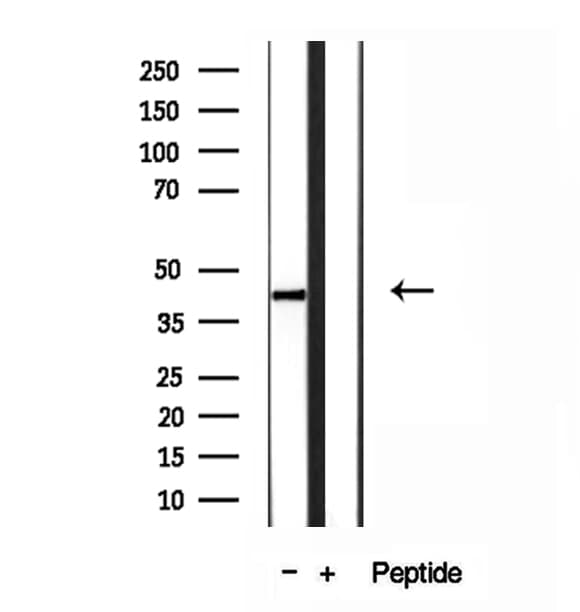 Polyclonal Rabbit anti-Human ABHD5 Antibody (IHC, WB)