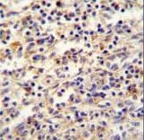 IGF2BP2 Antibody (aa530-556)
