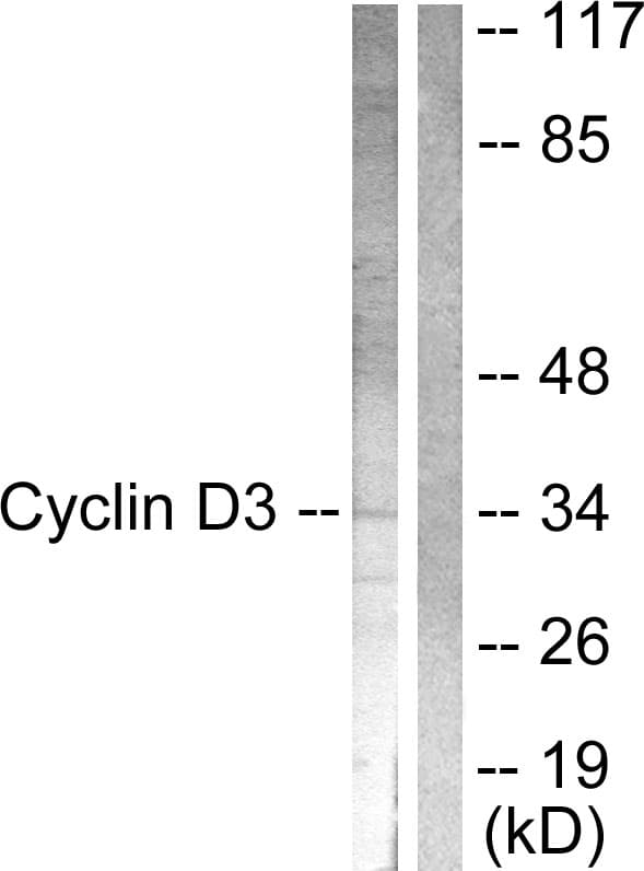 CCND3 / Cyclin D3 Antibody (aa243-292)