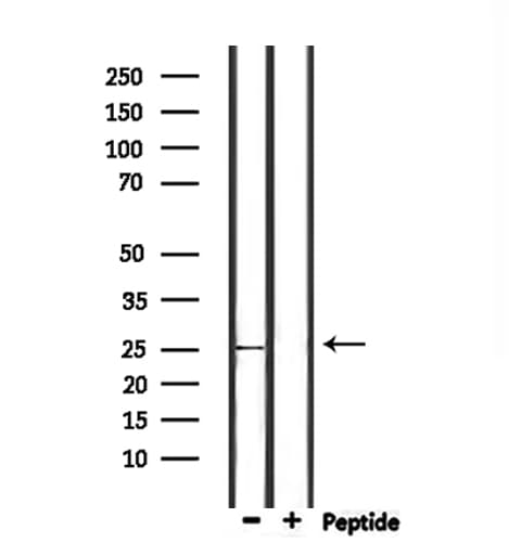 NOL12 Antibody