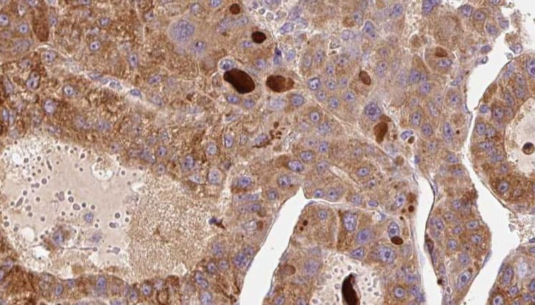 FcERI / Fc Epsilon RI Antibody