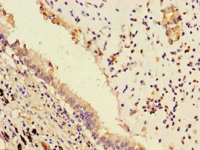 LPP3 / PPAP2B Antibody