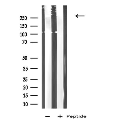 Polyclonal Rabbit anti-Human DEC-205 / CD205 / LY75 Antibody (IF, WB)