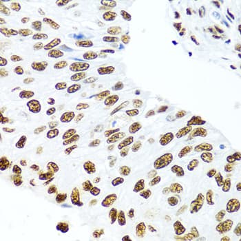 SSB / La Antibody