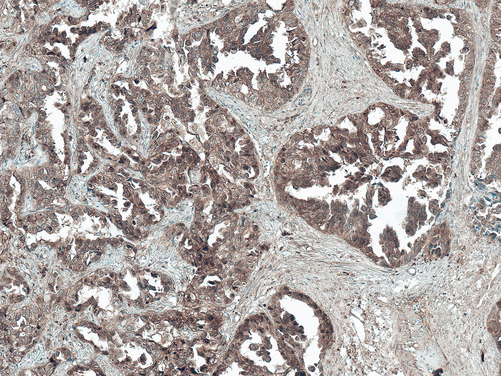 Tuberin / TSC2 Antibody (APC)