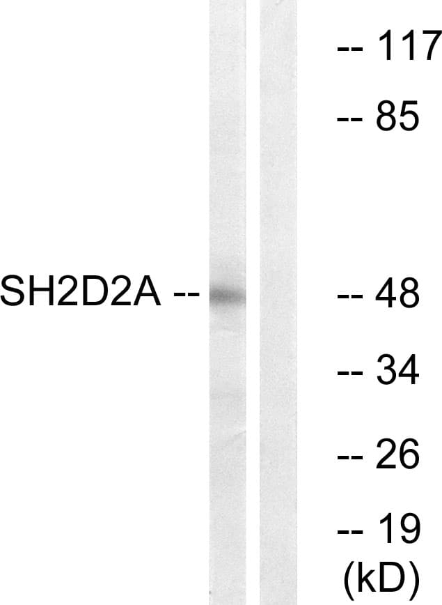 SH2D2A Antibody (aa211-260)