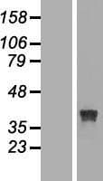 RRAGB / RAGB Protein (Over-Expression Lysate Myc-DDK (Flag))