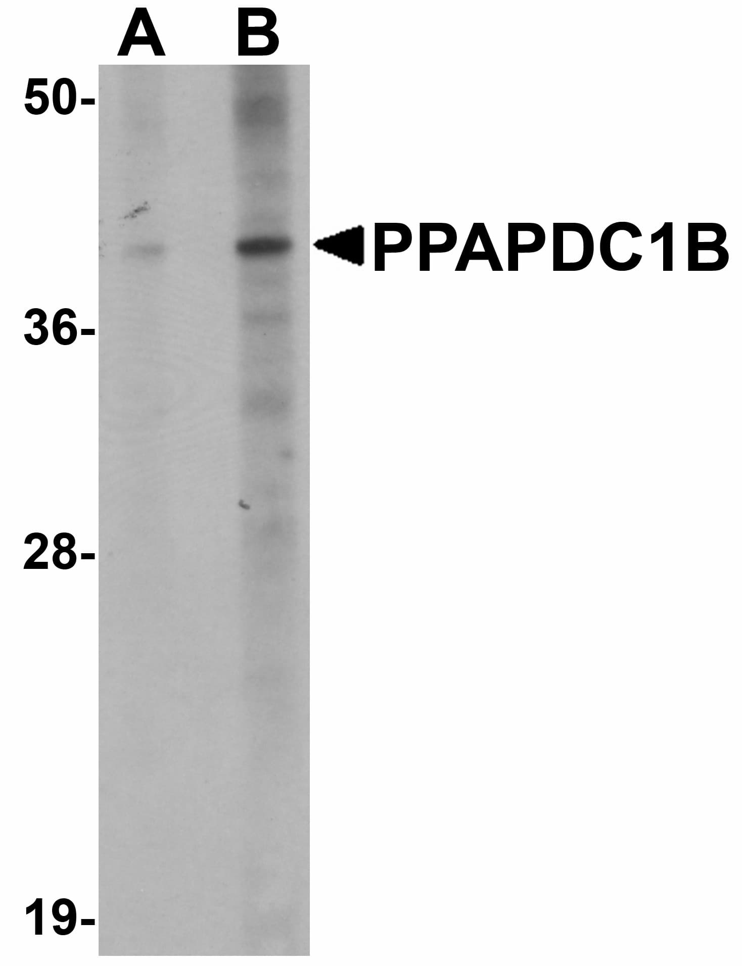 IHC-plus™ Polyclonal Rabbit anti-Human DPPL1 / PPAPDC1B Antibody (IHC, WB)