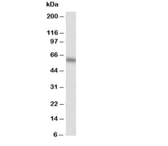 ALPL / Alkaline Phosphatase Antibody (aa21-35)