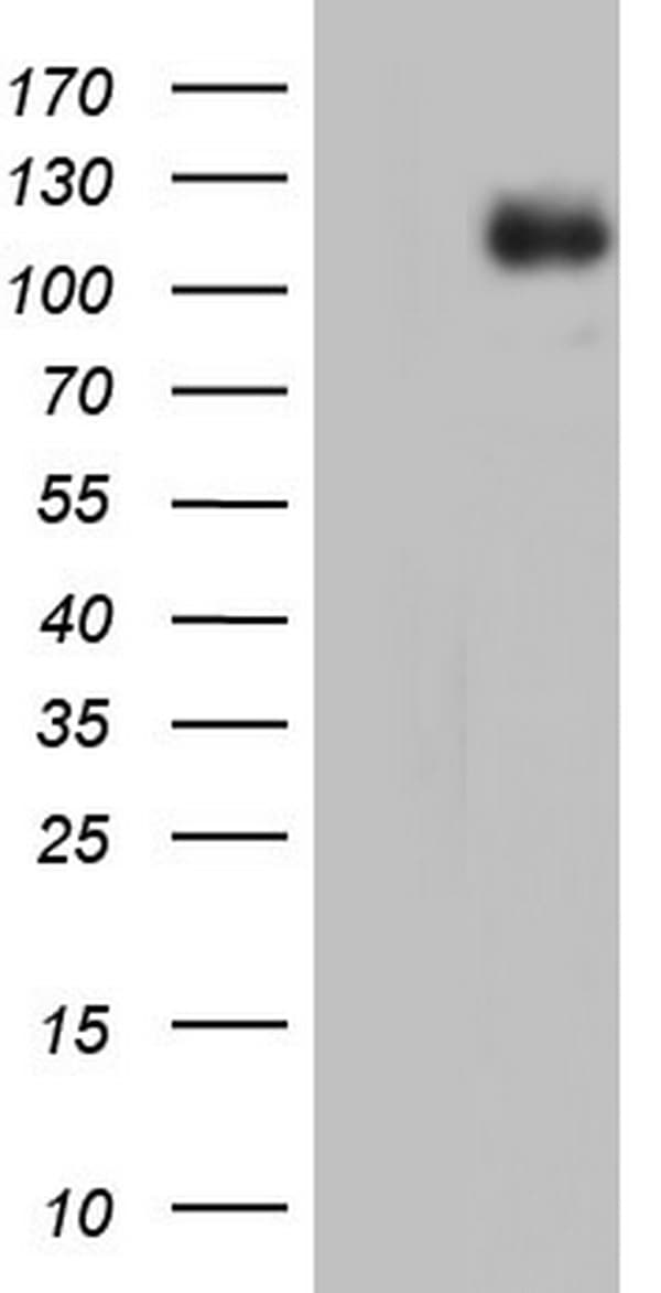 IFIH1 / MDA5 Antibody (clone OTI8C10)