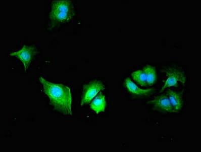 PLS3 / T Plastin Antibody