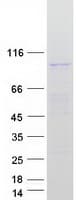Human TEX11 Protein (Recombinant Myc-DDK (Flag))