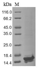 Vaccinia Virus Smallpox-A27L Protein (Recombinant 10His, N-terminus)