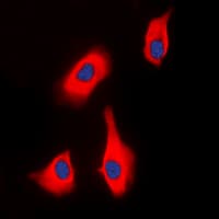 PTHR / PTHR1 Antibody (phospho-Thr1)