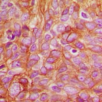 Polyclonal Rabbit anti-Human PRKCD / PKC-Delta Antibody (phospho-Thr507, IHC, WB)