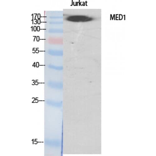 Polyclonal Rabbit anti-Human MED1 / TRAP220 Antibody (610-690 aa, Internal, IHC, WB)