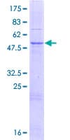 Human CTDNEP1 / DULLARD Protein (Recombinant GST)