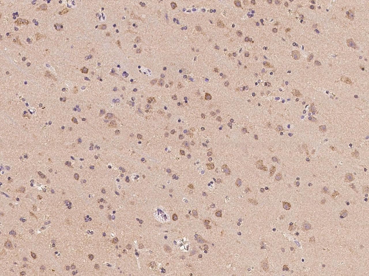 PCBP4 Antibody