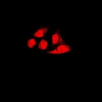 PSME1 Antibody