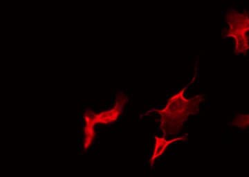Polyclonal Rabbit anti-Human CSF1R / CD115 / FMS Antibody (IHC, IF, WB)