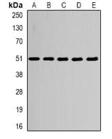 Polyclonal Rabbit anti-Human TUBA4A / TUBA1 Antibody (IHC, IF, WB)
