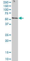 Monoclonal Mouse anti-Human STK38 Antibody (clone 2F6, IHC, IF, WB)