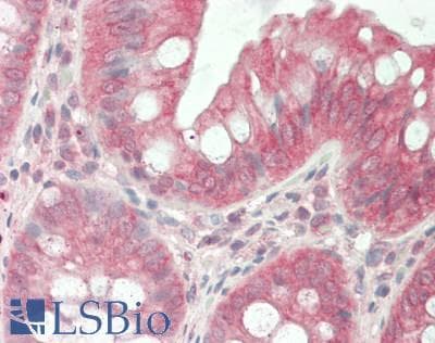 SLIT2 Antibody (aa1416-1528)