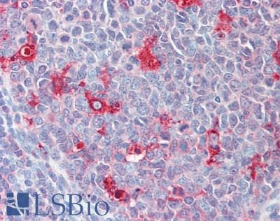 IHC-plus™ Polyclonal Rabbit anti-Human LGMN / Legumain Antibody (IHC, WB)