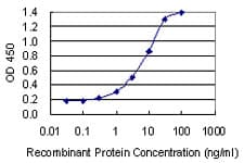 KDM6A / UTX Antibody (clone 4E7)