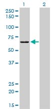 SARS / Serine-tRNA Ligase Antibody (clone 1H4)