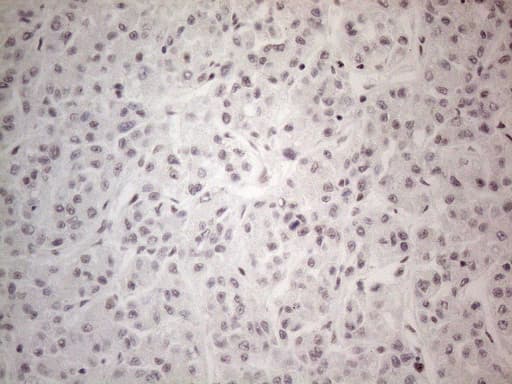 NR2C2 / TAK1 Antibody (aa1-241, clone OTI2H2)