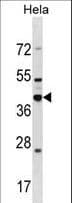 DND1 Antibody (aa198-226)