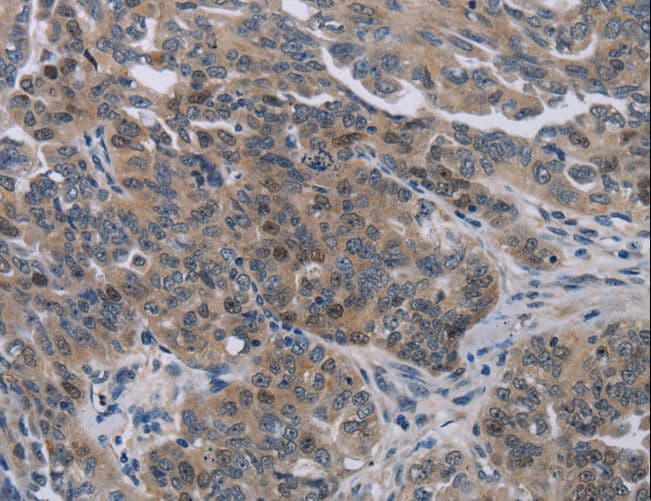 Polyclonal Rabbit anti-Human NOX1 Antibody (IHC)