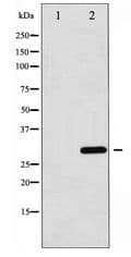 Polyclonal Rabbit anti-Human C/EBP Alpha / CEBPA Antibody (IHC, WB)