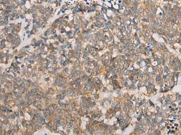 Polyclonal Rabbit anti-Human ATXN7 / SCA7 / Ataxin-7 Antibody (IHC)
