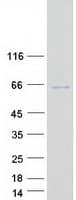 Human TSEN2 Protein (Recombinant Myc-DDK (Flag))