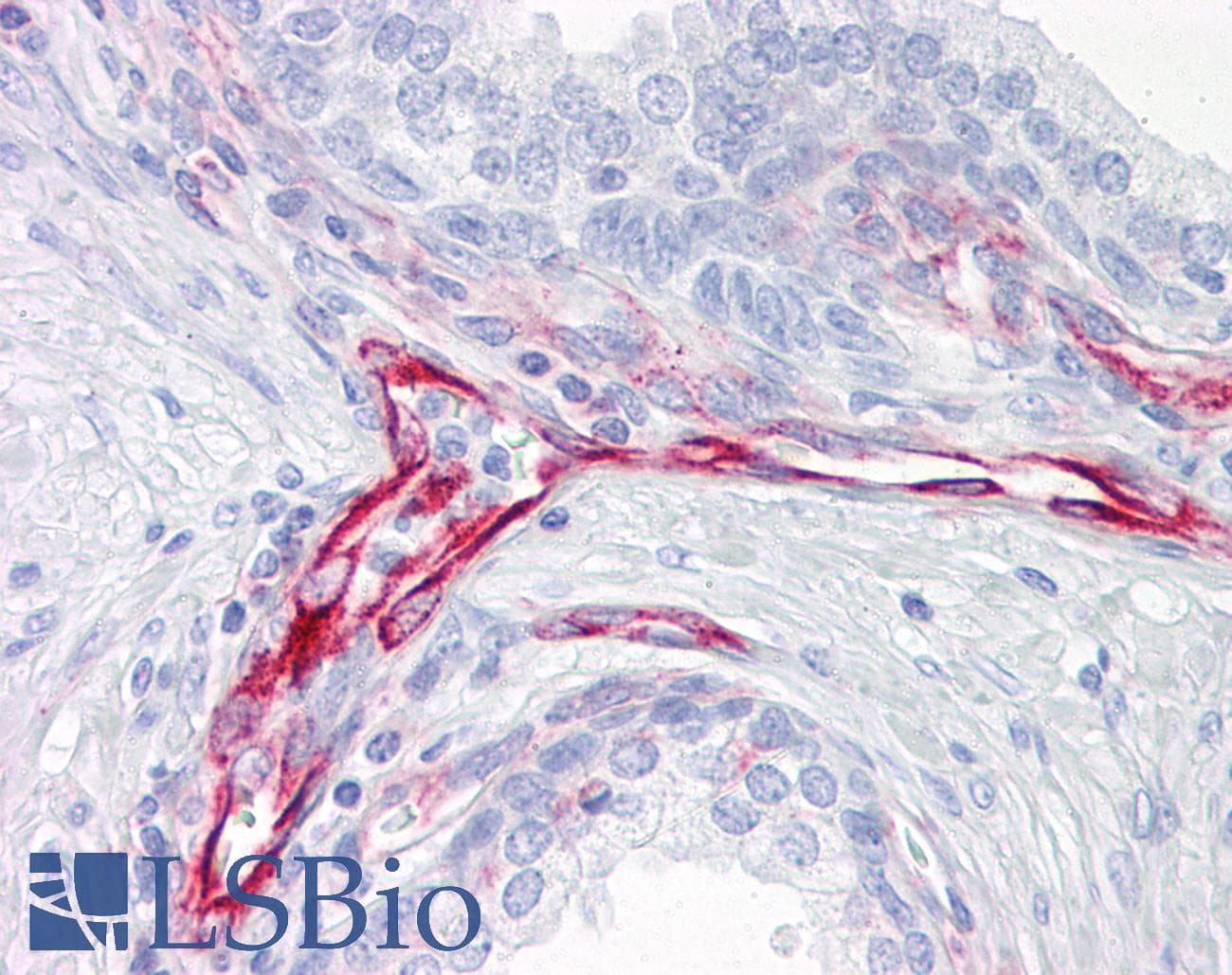 IHC-plus™ Vimentin Antibody (clone V9)