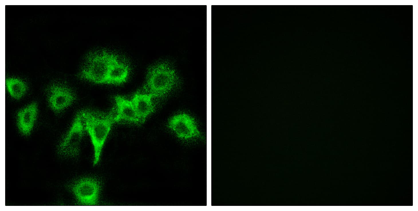 CDON / Cdo Antibody (aa511-560)