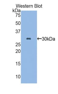 PLS3 / T Plastin Antibody (aa234-475, Biotin)