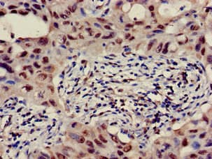 Polyclonal Rabbit anti-Human GALT4 / B3GALT4 Antibody (IHC, WB)