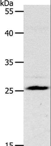 NQO2 Antibody